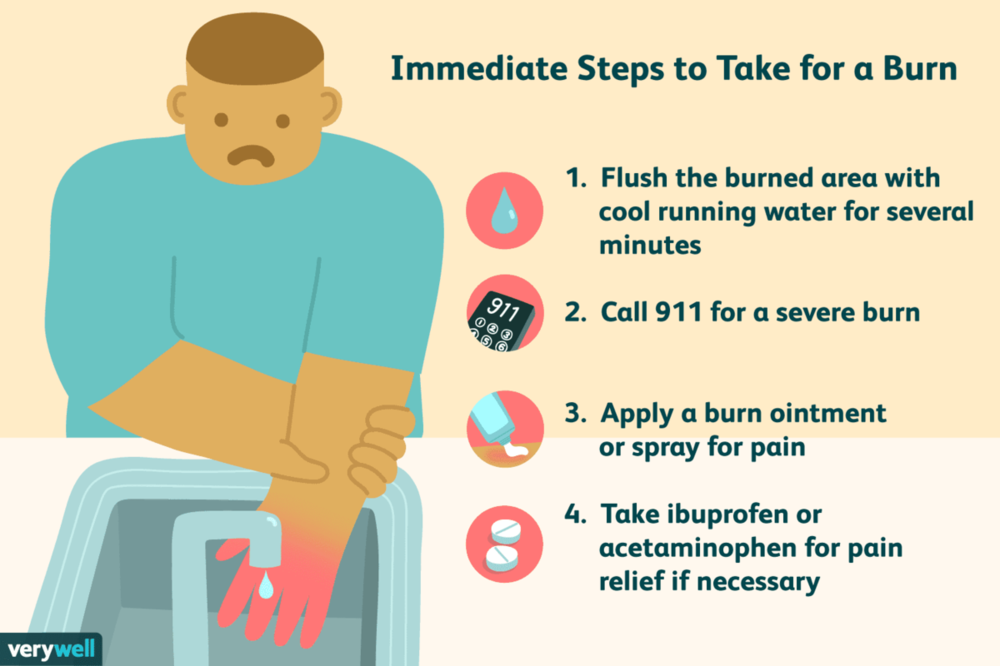 how-to-treat-a-burn-1298802-01-ef3683609e664a3ea3c46d6a619ac2f0.thumb.png.4b9edd6fd24b957847b16135a6a86055.png